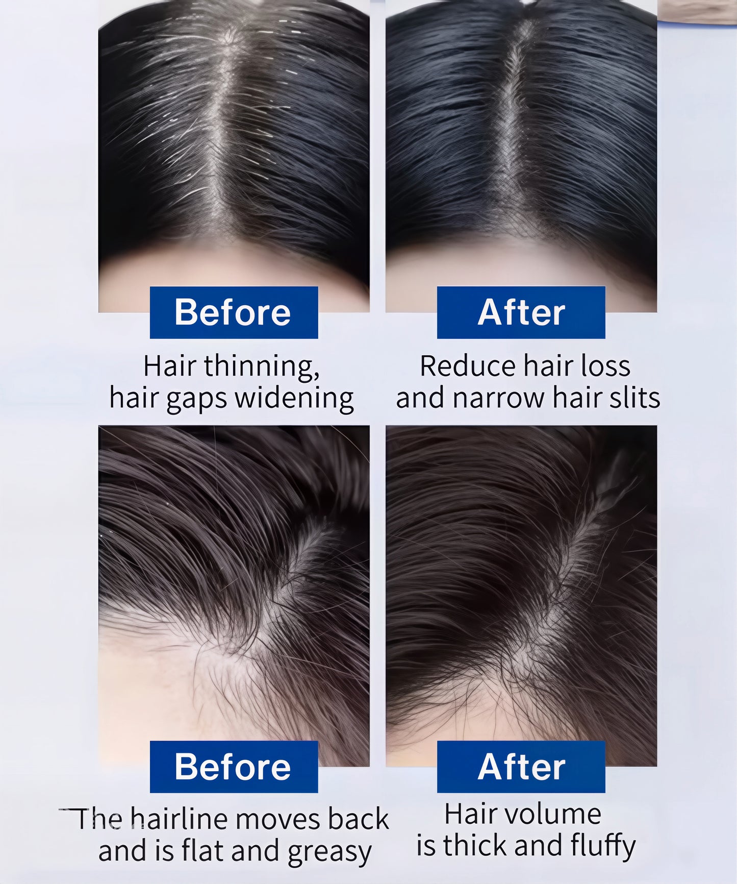 FEG PLUS Hair Growth Spray