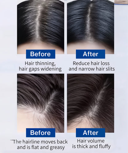 FEG PLUS Hair Growth Spray